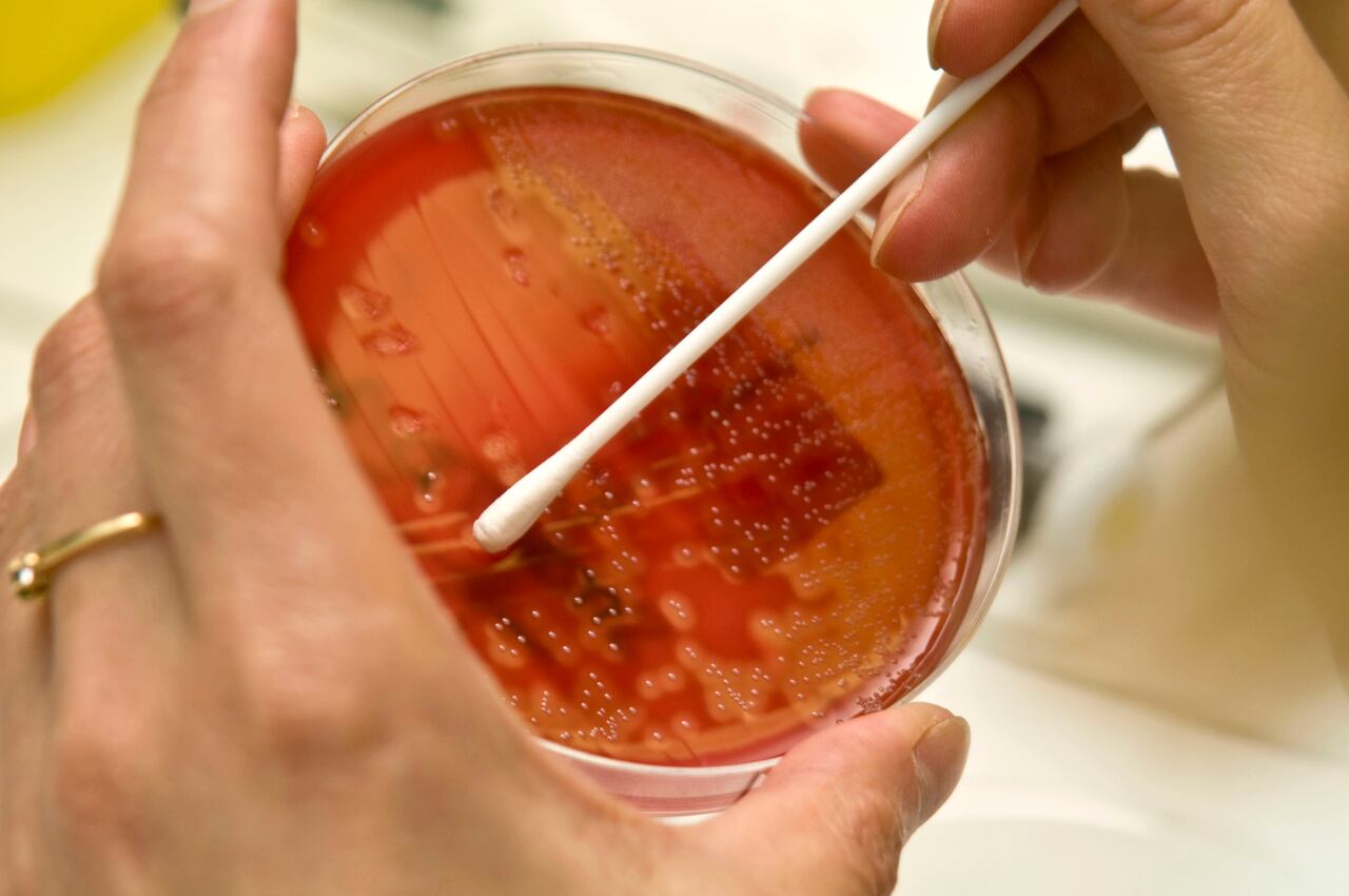 La empresa Viva1 requiere a un bacteriólogo para que se sume a su equipo  (Photo By BSIP/UIG Via Getty Images)