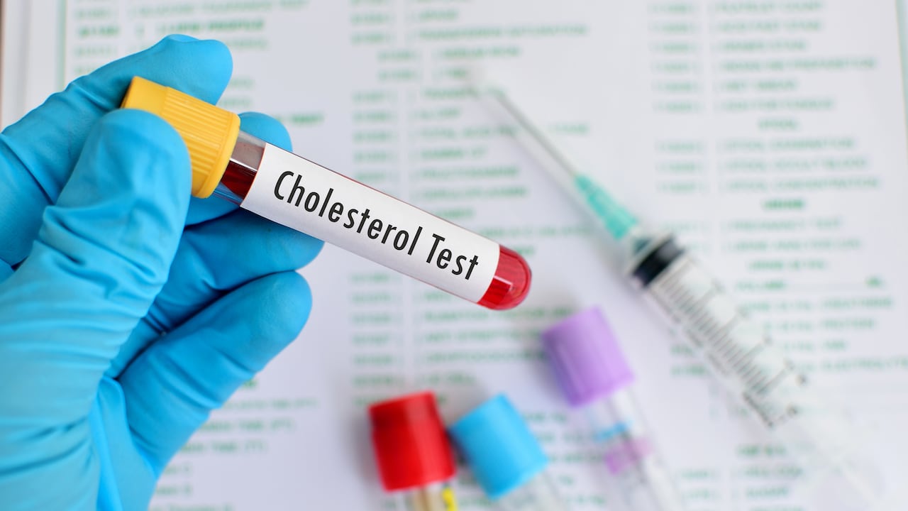 Los niveles de colesterol malo en la sangre pueden poner en riesgo la salud.