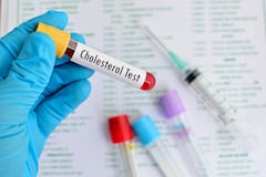Los niveles de colesterol malo en la sangre pueden poner en riesgo la salud.