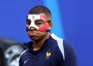 Kylian Mbappé, delantero de Francia, usando máscara de protección para la nariz