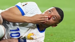 Kylian Mbappé tuvo un choque durante el estreno de Francia en la Eurocopa 2024